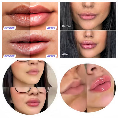 Glow Tulip Lip Plumper Spicule Plumping Lip Shot Extreme Lip Plumper Gloss Extreme Volume Serum Oil Sexy Beauty Makeup Korean